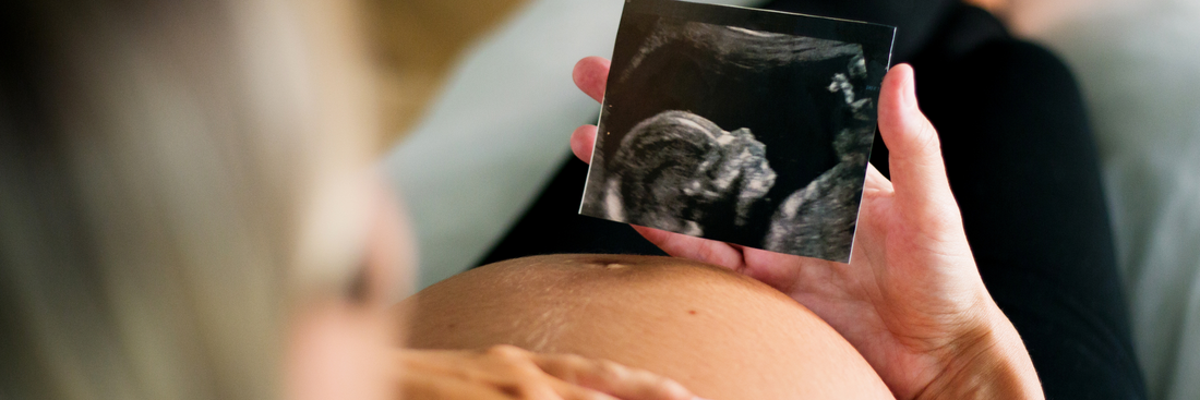 Infertility Awareness Month: Why Kiwis Want Kids